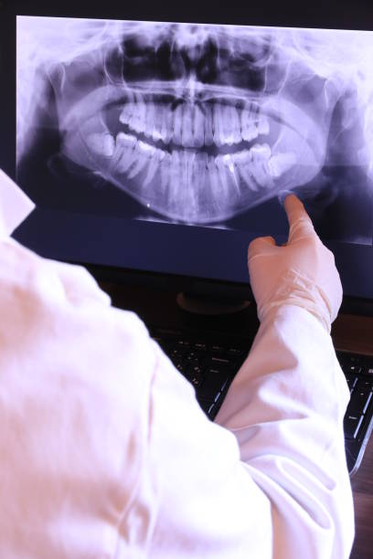 Best Emergency Root Canal Treatment in University Heights, OH