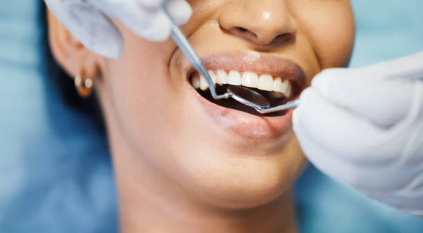 Best Emergency Dental Services for Seniors in University Heights, OH